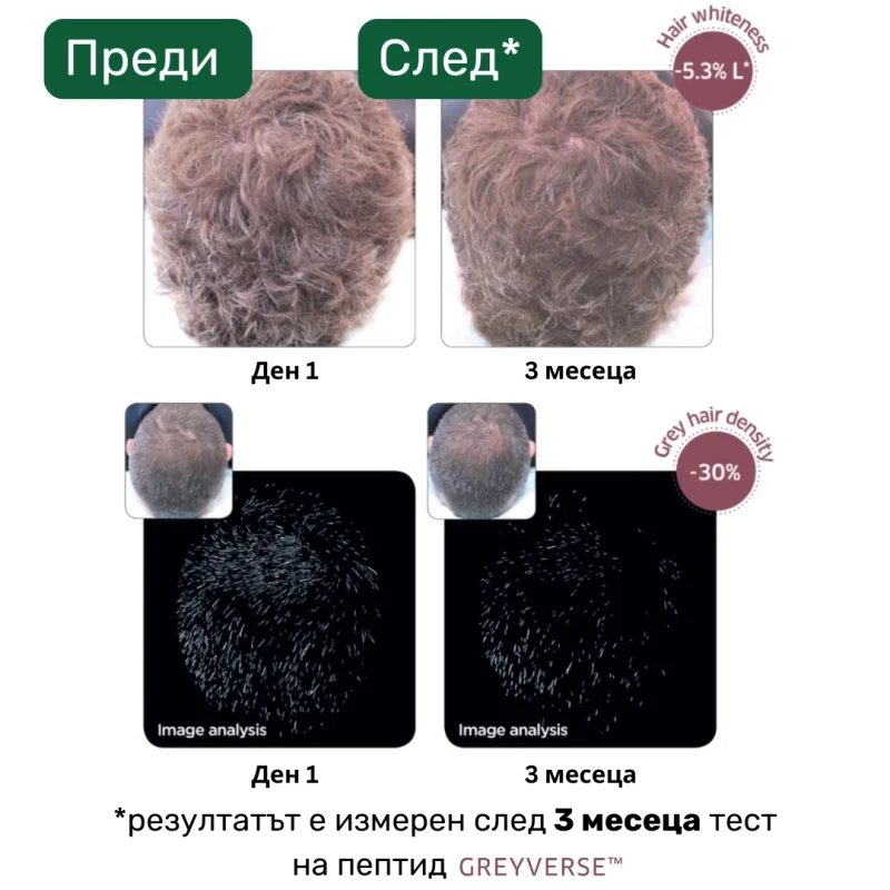 Сравнение на коса преди и след 3 месеца употреба на пептида Greyverse™ – намаляване на белите косми с 30% и възстановяване на цвета